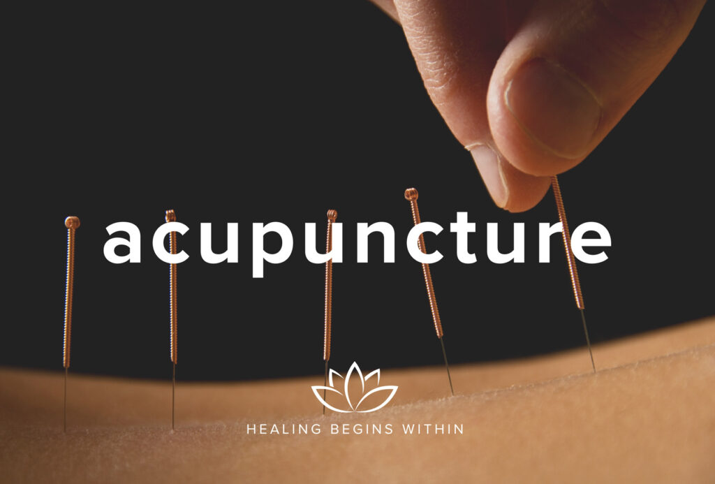 CPR for Acupuncture